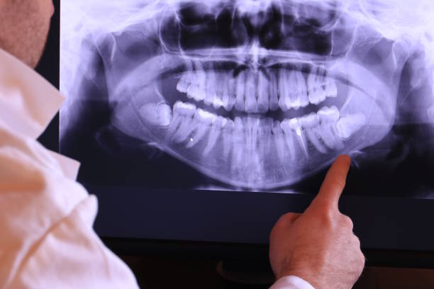 Best Walk-In Emergency Dentist in Wenona, IL
