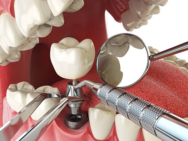 Best Emergency Broken Tooth Repair in Wenona, IL
